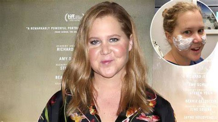 Amy Schumer Dissolves Fillers After Plastic Surgery Procedure: ' I Looked Like Malificent'