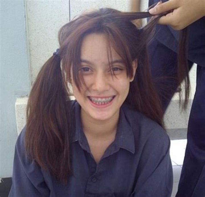 Chanya McClory in braces