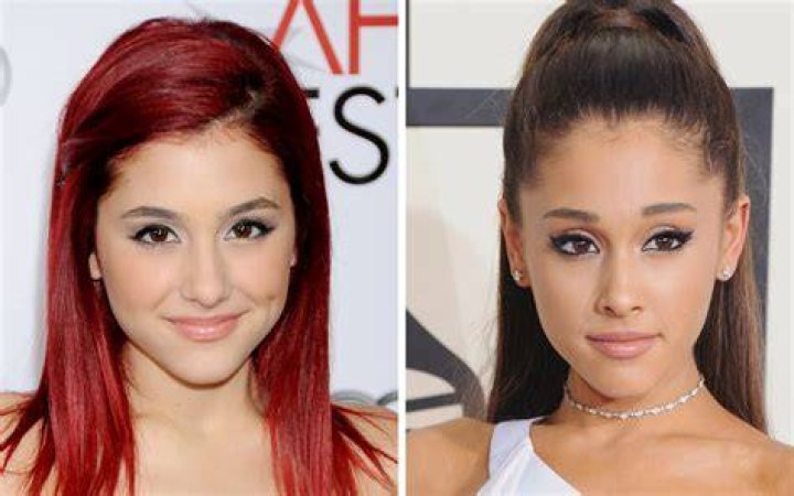 The Curious Case of Celebrities’ Ever-Changing Eyelids
