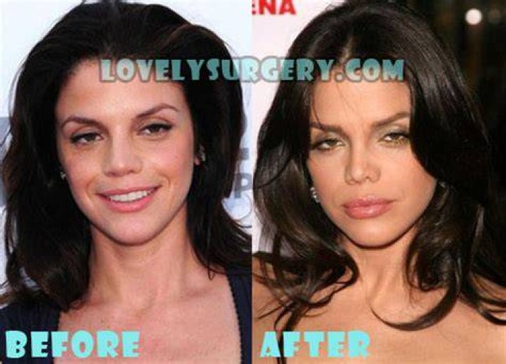 vanessa ferlito plastic surgery vanessa ferlito plastic surgery